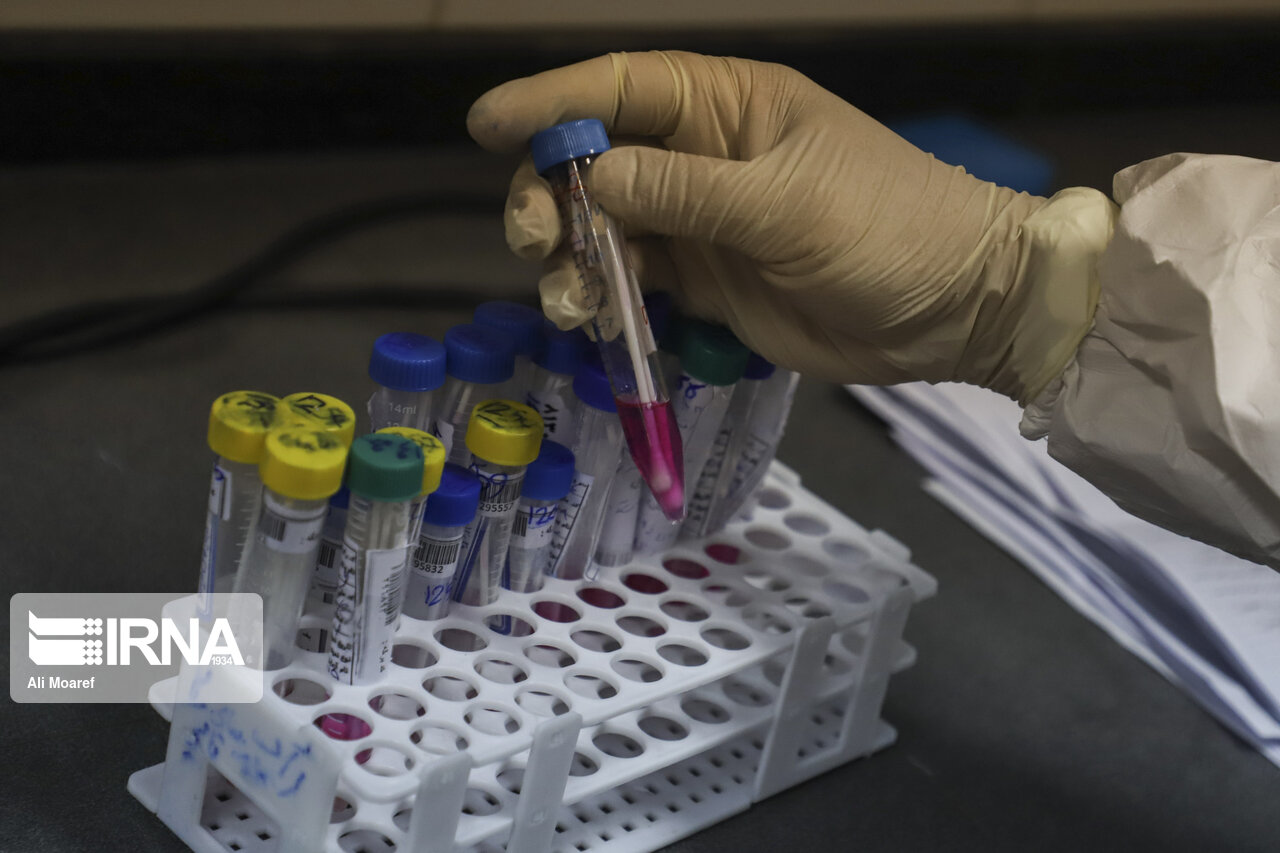 یک هزار و ۳۰۰ تست سریع کرونا در استان مرکزی انجام شد یک هزار و ۳۰۰ تست سریع کرونا در استان مرکزی انجام شد