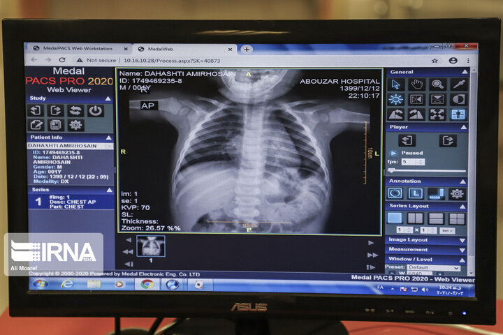 بیماران مزمن قلبی در اولویت واکسیناسیون کرونا قرار گیرند