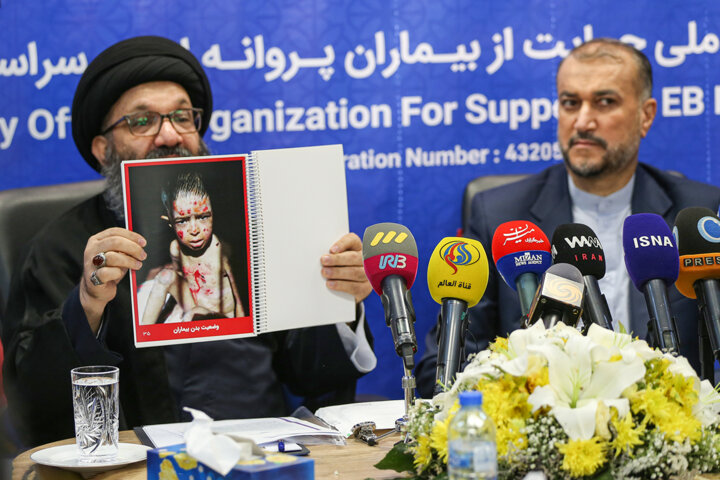 امیرعبداللهیان؛ تنها دیپلماتی که رنج بیماران پروانهای را لمس کرد 2 امیرعبداللهیان؛ تنها دیپلماتی که رنج بیماران پروانهای را لمس کرد