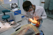 خدمات دندانپزشکی تامین اجتماعی چیست؟/ سلامت دهان و دندان نیازمند توجه بیشتر بیمه‌ها