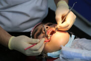 خدمات دندانپزشکی به بیماران خاص در زنجان ارائه می‌شود