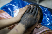 ۲۰ نفر در حوادث چهارشنبه سوری دزفول مصدوم شدند