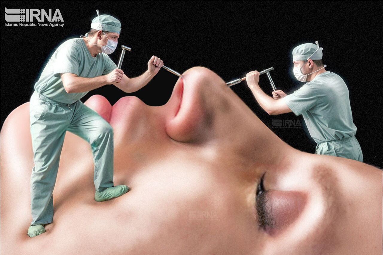 نیمرخ جراحیهای زیبایی؛ دیده میشوم پس هستم نیمرخ جراحیهای زیبایی؛ دیده میشوم پس هستم