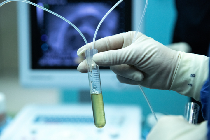 مثلث طلایی شکست سرطان