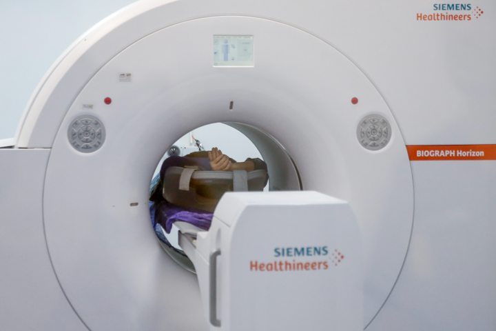 استاد دانشگاه: سن ابتلا به برخی سرطان‌ها در کشور پایین آمده است