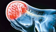 ۳ درصد مبتلایان کرونا به سکته مغزی دچار می‌شوند