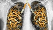 ۱۰ سرطان اصلی ارتباط مستقیم با مصرف سیگار دارند