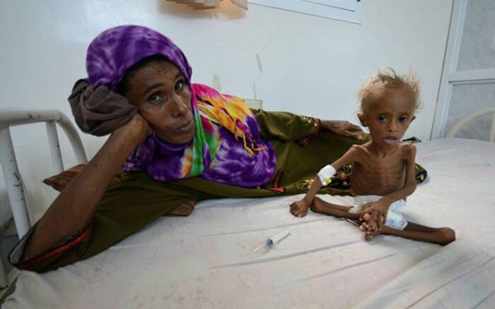سازمان ملل: ۲۰ میلیون یمنی در خطر گرسنگی هستند