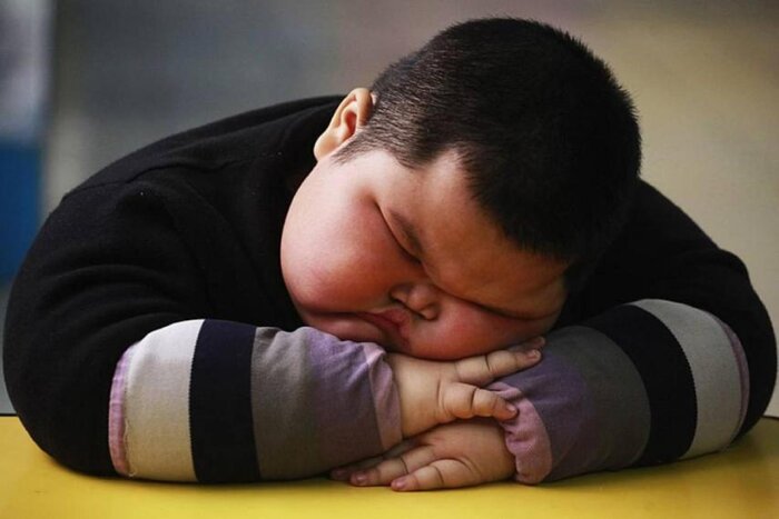 چاقی میراث بی‌صدای کرونا برای کودکان در جهان 