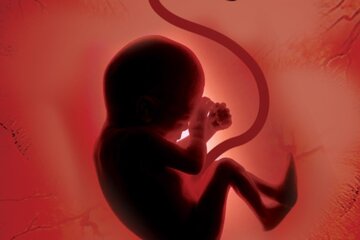 سقط جنین در آذربایجان‌شرقی بر مدار افزایش