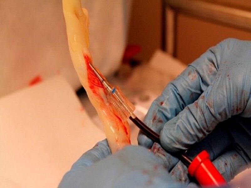 بیش‌ از ۱۲۰ هزار نمونه خون بند ناف در مرکز رویان ذخیره شد