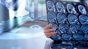 موفقیت فاز اول کارآزمایی بالینی درمان تومورهای مغزی توسط پژوهشگر رویان