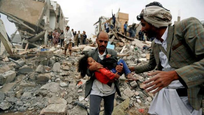 وزیر بهداشت یمن: جنگ سالانه جان ۱۰۰ هزار کودک را می گیرد
