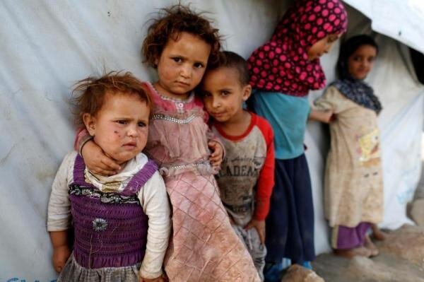 یونیسف: ۲.۴ میلیون کودک یمنی دچار سوء تغذیه می‌شوند