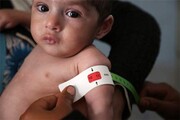 کمیته امداد گلستان از ۲ هزار کودک دچار سوء تغذیه حمایت می‌کند