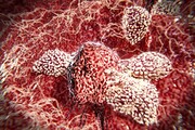 نحوه محافظت سلول‌های ایمنی از خود در برابر سرطان کشف شد