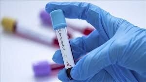 مراکز آزمایشگاهی تشخیص کرونا در مشهد افزایش یافت