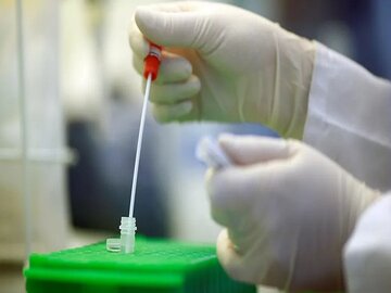 ژنوم ویروس کرونا در کشور تعیین توالی شد