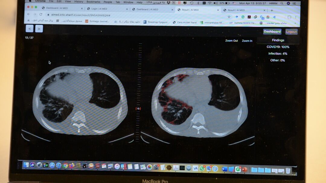 عرضه رایگان سامانه هوشمند ایرانی تشخیص کووید۱۹ به جهان