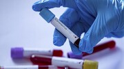 روزانه ۱۰۰ مورد نمونه‌گیری ویروس کرونا در چهارمحال و بختیاری انجام می‌گیرد