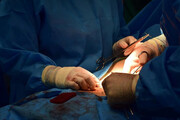 اولین عمل جراحی ترمیم پارگی قلب در دیواندره با موفقیت انجام شد