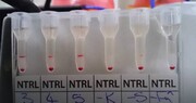 تشخیص ۲۰ دقیقه‌ای ویروس کرونا با یک آزمایش خون جدید