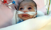 جراحی قلب باز نوزاد ۲۶ روزه در مشهد با موفقیت انجام شد