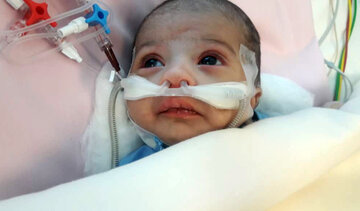 جراحی قلب باز نوزاد ۲۶ روزه در مشهد با موفقیت انجام شد
