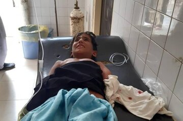 حمله گاندو به پسر بچه‌ روستایی در هوت‌گت چابهار