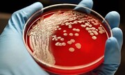 نابودی باکتری‌های مقاوم در برابر آنتی‌بیوتیک با ترکیب جدید