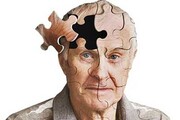 Her 7 dakikada bir İran vatandaşı Alzheimer hastalığına yakalanmakta