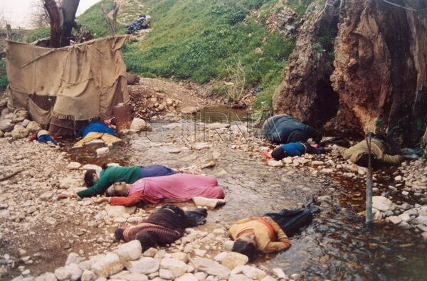 Scars of chemical bombardment still exists on face of Halabja