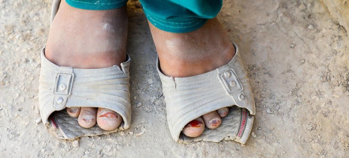 سازمان ملل خواستار همبستگی با فقرای جهان شد
