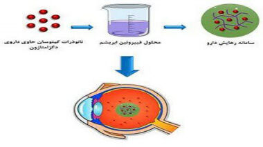 طراحی روشی برای کنترل التهاب چشم به همت محققان ایرانی