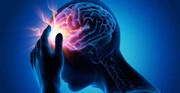 کووید-۱۹ با بدترین عوارض سکته مغزی مرتبط است