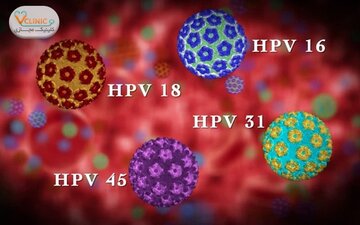 ویروس پاپیلومای انسانی درمان ندارد؛ فقط پیشگیری