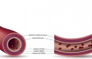 کشف ارتباط ساختار مویی دیواره رگ‌ها با درمان دیابت