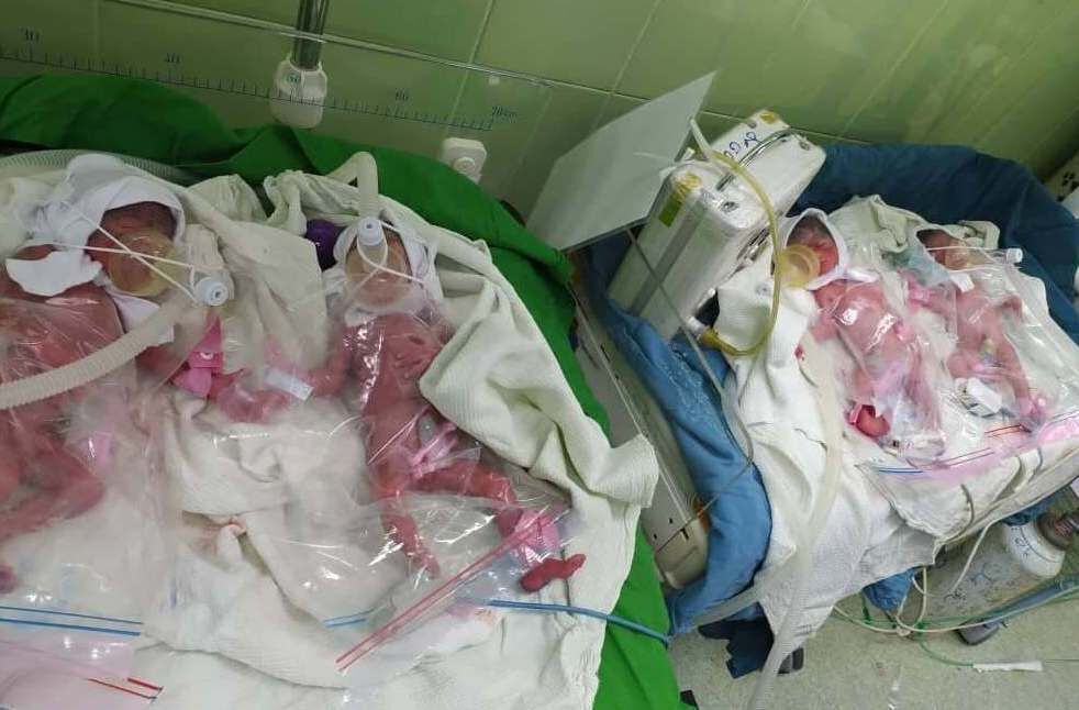 چهارقلوزایی زن ۱۸ ساله گرگانی و چند خبر کوتاه از گلستان