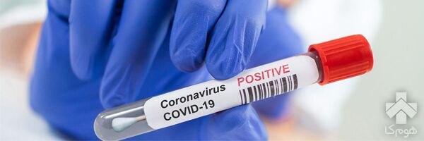 تست کرونا در منزل برای جلوگیری از رکوردی تازه!