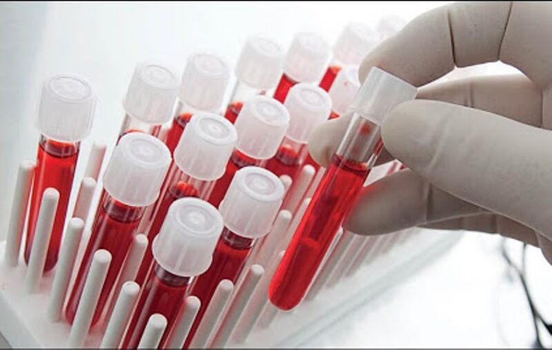 ۲۵۰ سلول بنیادی خون بند ناف استان مرکزی ذخیره شد 