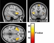 واکنش شدید به صدای جویدن با اتصال مغزی فوق حساس ارتباط دارد