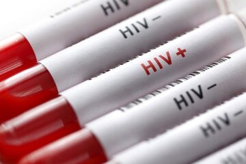 ایدز؛ کاهش سن مبتلایان، تغییر راه انتقال و ضرورت اطلاع رسانی