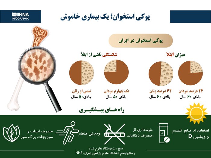 پوکی استخوان با تشخیص زود هنگام قابل درمان است