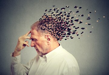بهبود حافظه مبتلایان به آلزایمر با داروی ام اس