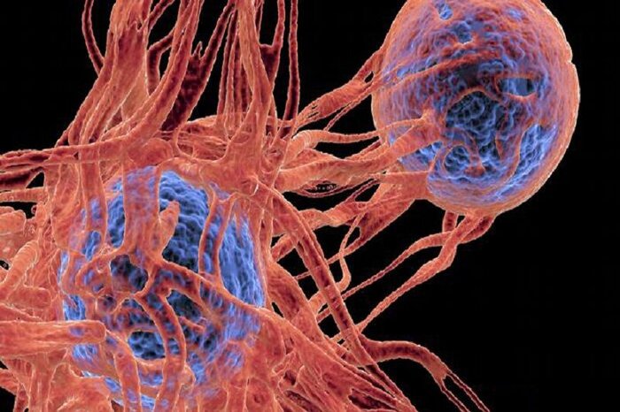 مردان بعد از ۵۰ سالگی گرفتار بزرگی پروستات می‌شوند/ طولانی مدت پشت میز ننشینید