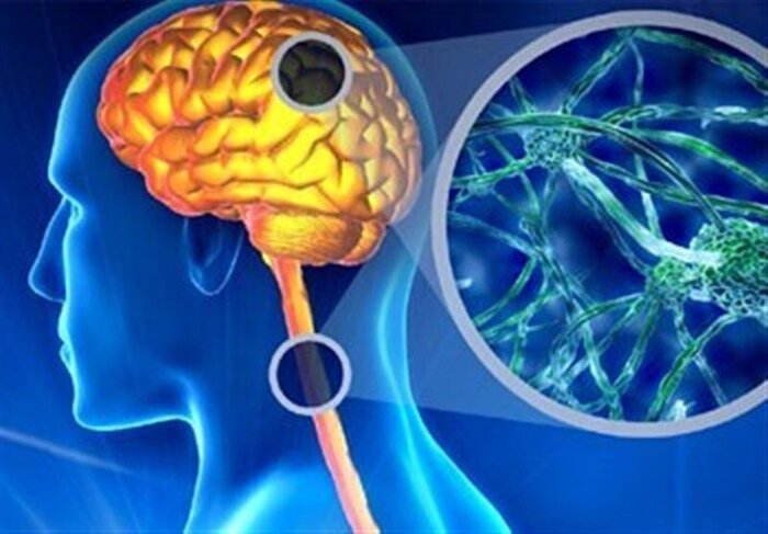 چتر حمایتی دولت سیزدهم بر سر بیماران «اس ام ای»