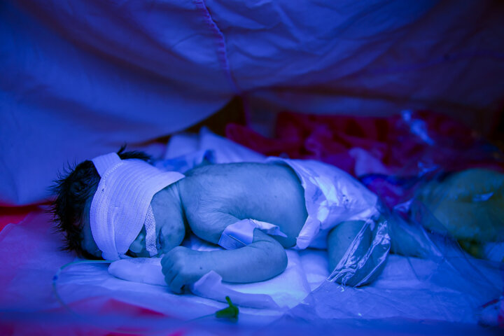 این درمان دیگر لاکچری نیست