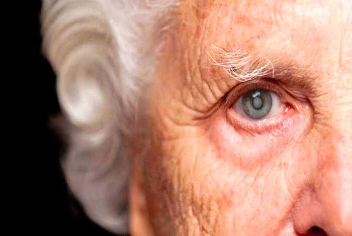 چشم‌ها در گذر زمان؛ چگونه از بینایی خود مراقبت کنیم؟