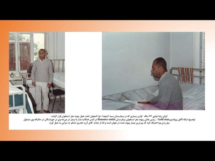 احیای مجدد پیوند مغز استخوان در اصفهان پس از ۳۰ سال تعطیلی