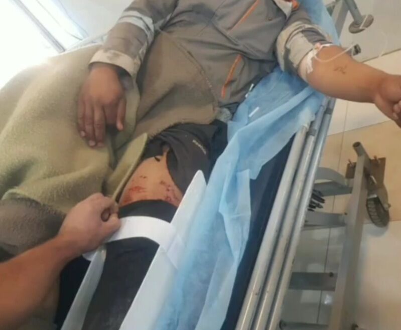 ۲ نیروی پیمانکار آب وفاضلاب صالح شهرگتوند مجروح شدند